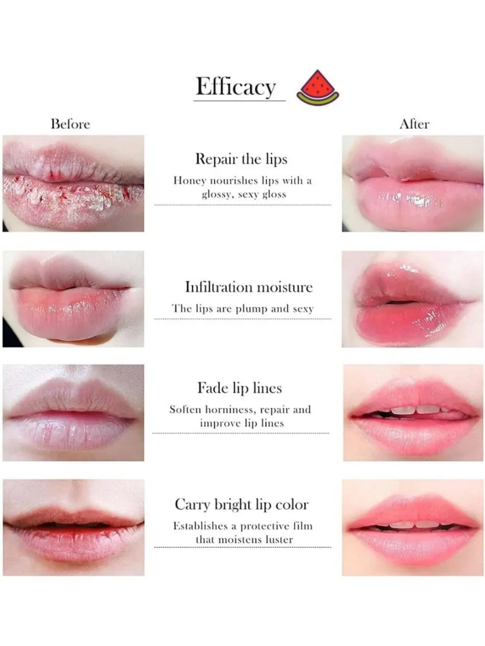 10 PCS Moisturizing Lip Balm Set - Honey Pot, Fruit Flavors & Lip Mask Bulk